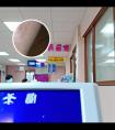 极速308准分子疗法