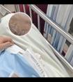 311光疗10次白斑缩小