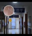 激光308准分子是什么