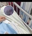 卡泊三醇倍他米松软膏适合白癜风